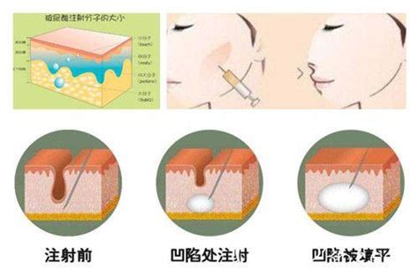 蜂目面相